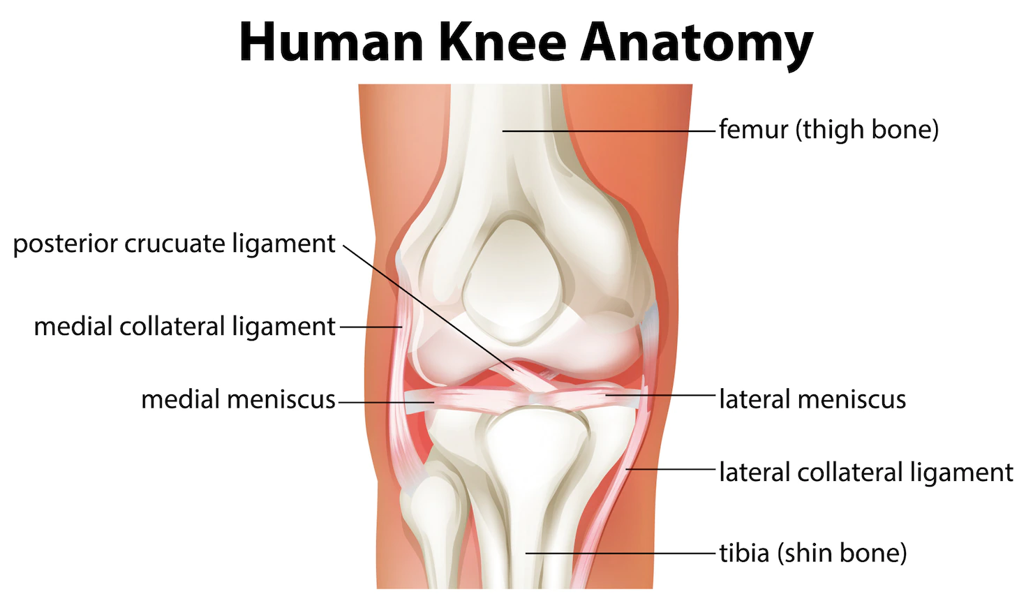 natiahnuté šľachy v kolene, Problém s bolesťou kolena: Ako riešiť natiahnuté šľachy v kolene?
